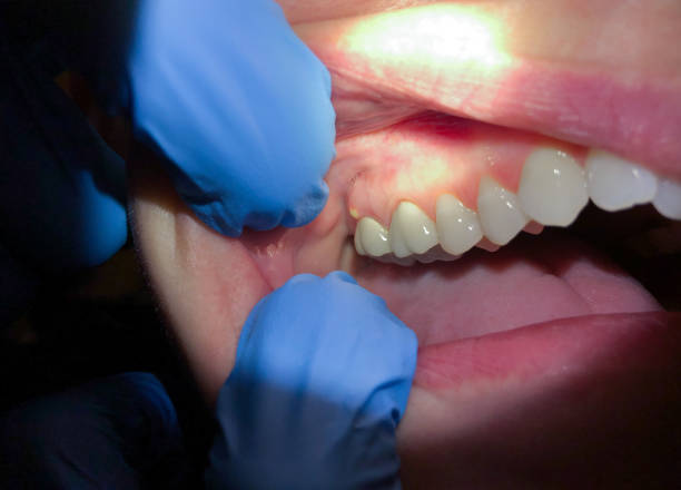 Best Emergency Gum Pain Relief  in Shadeland, IN