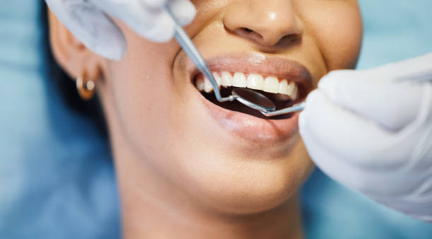 Best Knocked-Out Tooth Emergency  in Shadeland, IN